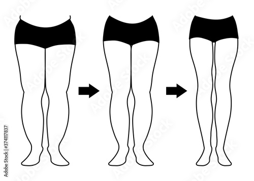 ダイエットの経過　脚やせ　モノクロ