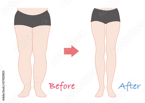 ダイエット　ビフォーアフター（脚やせ）カラー