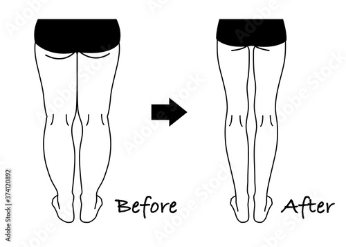 ダイエット　ビフォーアフター（脚やせ）モノクロ