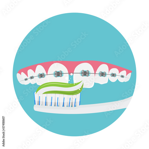 Daily dental care for braces, oral hygiene, orthodontics concept, vector illustration.