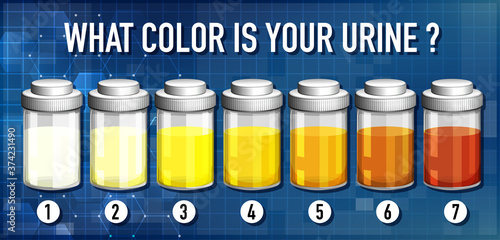 Illustration of urine color chart