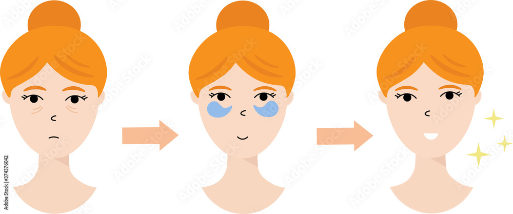 Vector illustration of the women with eye patches, isolated on white background. Instruction for applying eye patches. Flat style. Vector illustration of the women with eye patches, isolated on white background. Instruction for applying eye patches. Flat style.