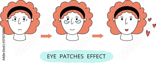 Vector illustration of the women with eye patches, isolated on white background. Instruction for applying eye patches. Doodle style. Eye patches effect.