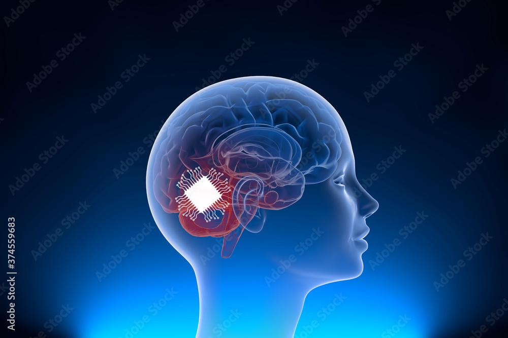 Obraz premium Neuralink surgically implant some computer components onto the surface of your brain to control equipments and improve the memory with neural link. 