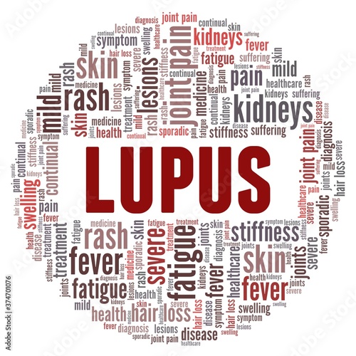 Lupus autoimmune disease vector illustration word cloud isolated on a white background.