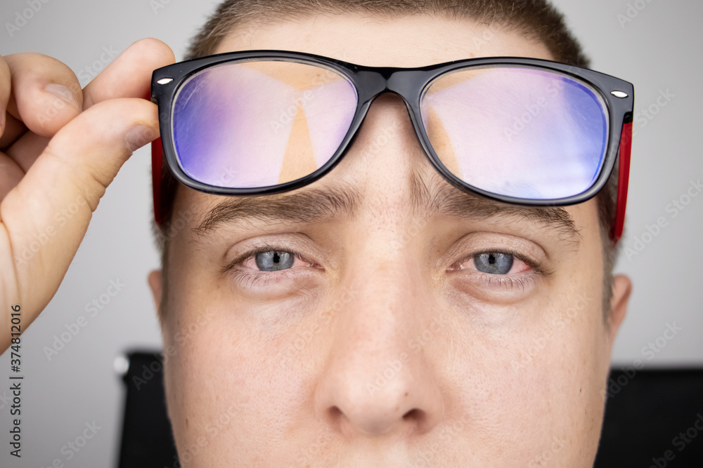 The man takes off his glasses and shows tired red eyes on a white background. Concept of eye fatigue from computer and fatigue from work. Pain in the eyes and forehead, migraine, eye diseases The man takes off his glasses and shows tired red eyes on a white background. Concept of eye fatigue from computer and fatigue from work. Pain in the eyes and forehead, migraine, eye diseases