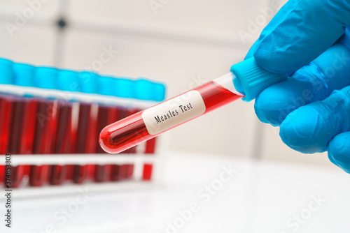 Blood sample   test tube in doctor hand for  Measles test