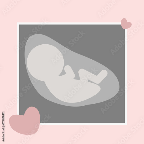 Vector illustration of an ultrasound scan of the unborn child.
