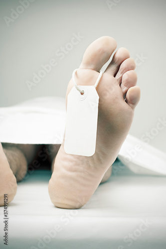 Foot of a dead person. photo