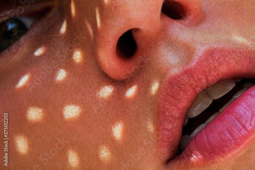 sunlight spots on a cheek closeup