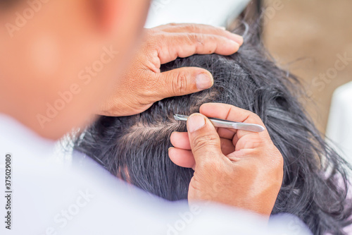 A man's hand is using pliers to pull his wife's damaged hair.