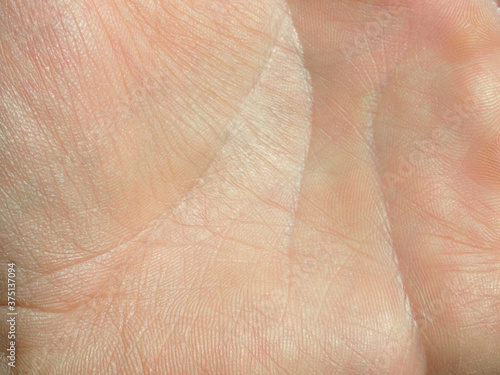 Dry man hand skin from close up © Jarka