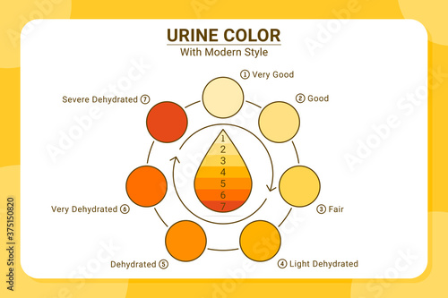 Urine color vector illustration isolated on white background. Vector for all project, web design, medical and other. Equipped with complete information and easy to understand. Flat design. EPS file