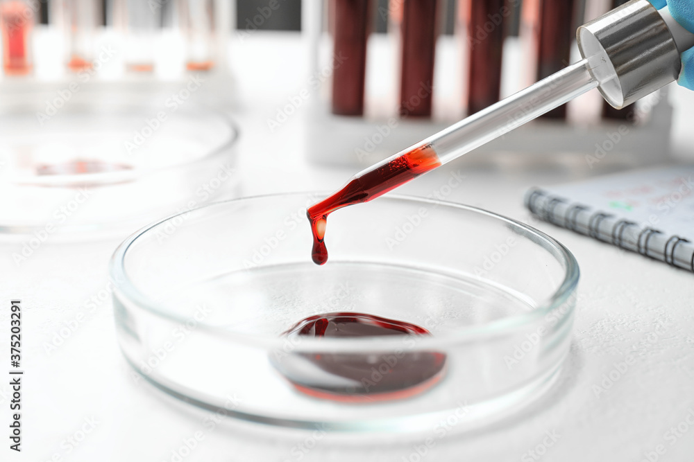 Dripping blood from pipette into Petri dish on table, closeup. Laboratory analysis Dripping blood from pipette into Petri dish on table, closeup. Laboratory analysis
