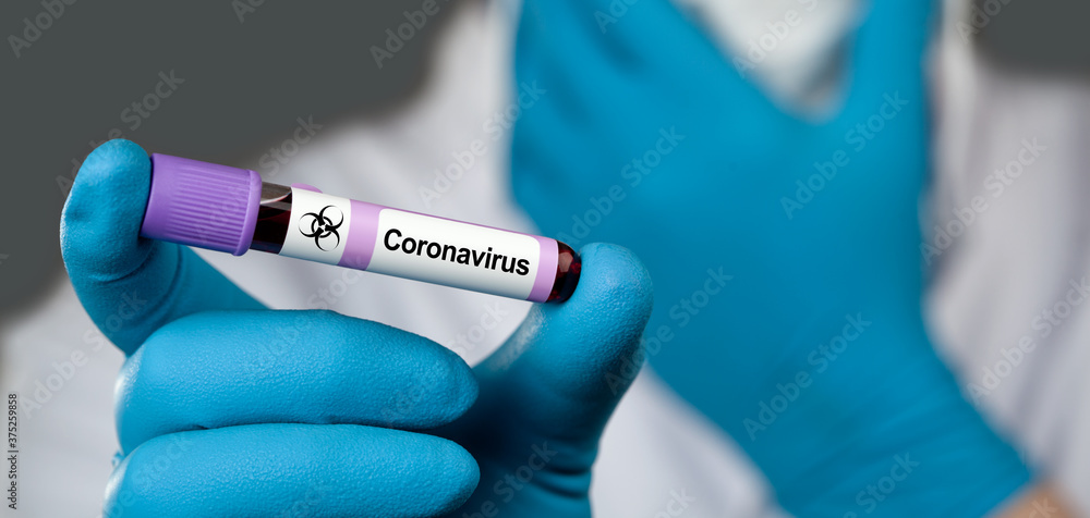Coronavirus 2019-nCoV Blood Sample. Coronavirus 2019-nCoV Blood Sample.