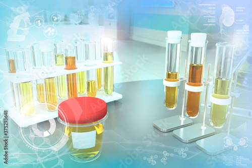 Urine sample test for ph or amorphous urates - test tubes in modern medical college facility, medical 3D illustration photo