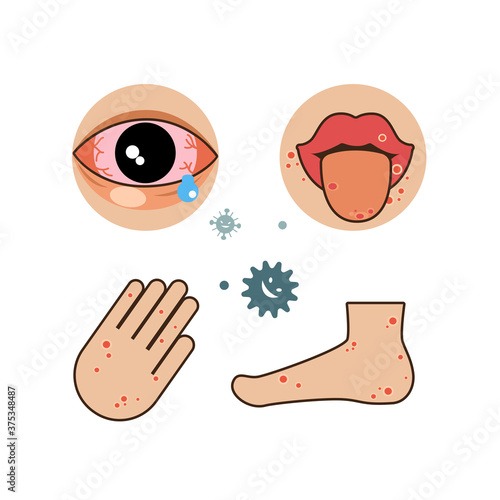 disease