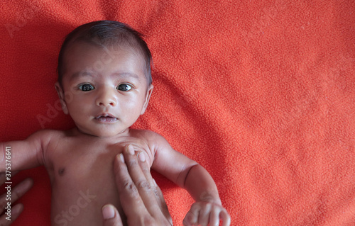malnourished baby looking at the camera lying on orange red velvet cloth background. protein energy malnutrition concept image photo