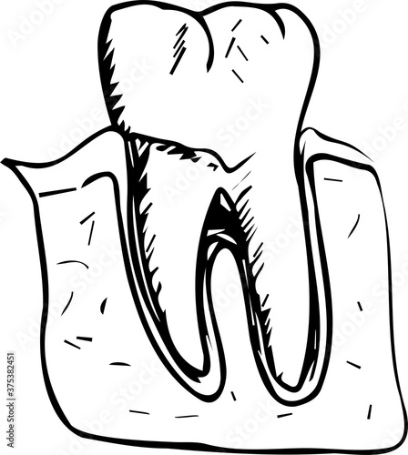 vector illustration isolated on white background hand drawing molar in the gum