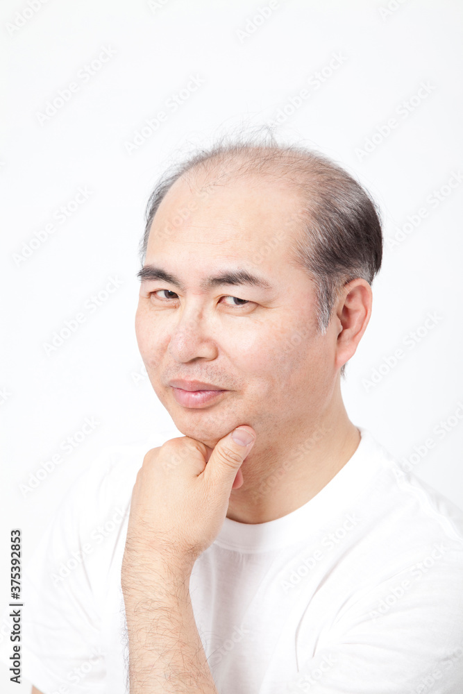 薄毛の中年男性 薄毛の中年男性