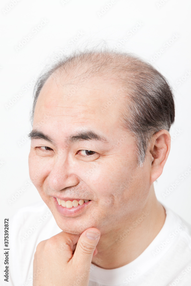 Fototapeta premium 薄毛の男性