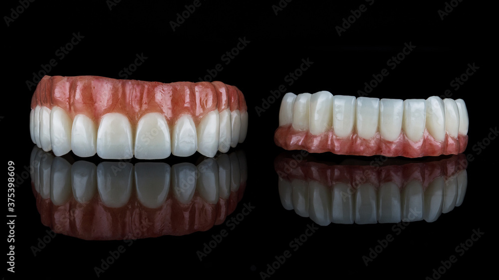 excellent composition of temporary dentures of the upper and lower jaws with artificial gums, filmed on black glass with reflection excellent composition of temporary dentures of the upper and lower jaws with artificial gums, filmed on black glass with reflection