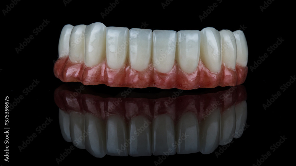 lower jaw prosthesis with artificial red gum and bright white teeth, filmed on black glass with reflection lower jaw prosthesis with artificial red gum and bright white teeth, filmed on black glass with reflection