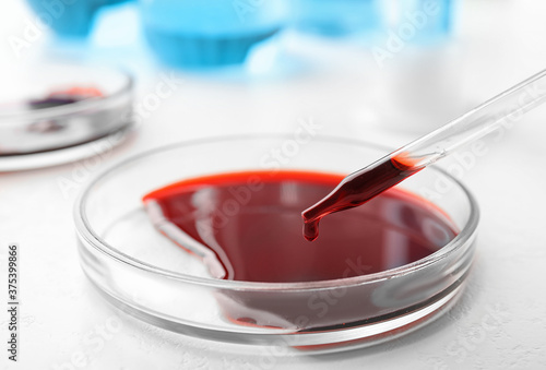 Dripping blood from pipette into Petri dish on table, closeup. Laboratory analysis