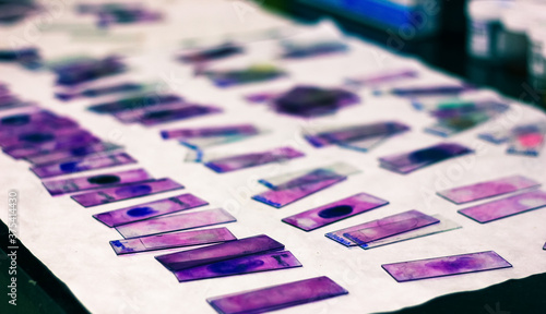 stained glass slides of peripheral blood smear with violet leishman giemsa stain in hematology pathology laboratory