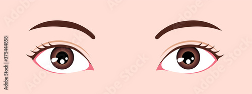Eye shapes ( eyeball size and position ) vector illustration