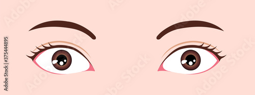 Eye shapes ( eyeball size and position ) vector illustration