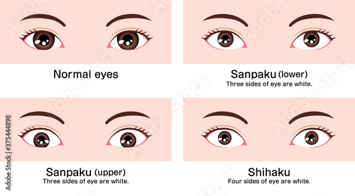 Various eye shapes (different eyeball size and position ) vector illustration ( Classifications in Asia )