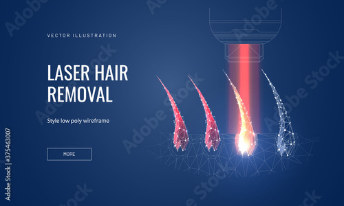 Laser hair removal concept in polygonal futuristic style for banner. Vector illustration of a demonstration of the process of laser epilation, hair follicles with lus from the apparatus