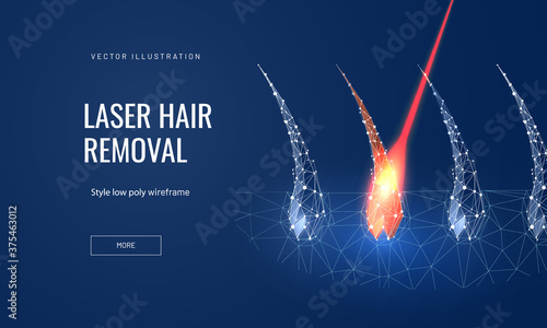 Laser hair removal concept in polygonal futuristic style for landing page. Vector illustration of a hair follicle with a laser to demonstrate the removal process on a blue background