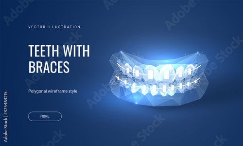 Dental braces vector illustration in futuristic polygonal style. Dental orthodontic treatment for bite improvement