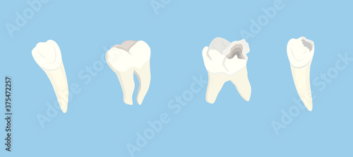 vector illustration isolated on blue background healthy teeth and teeth with caries