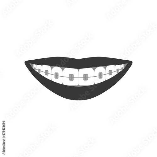 vector orthodontics sign on white background.teeth with braces.vector illustration.