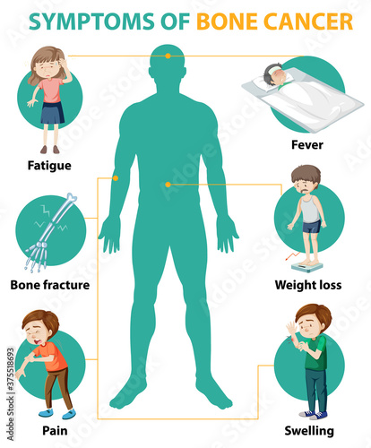 Medical infographic of bone cancer symptoms