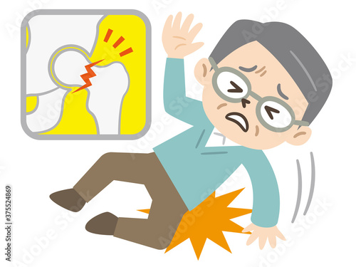 転倒して骨折をしたシニア男性