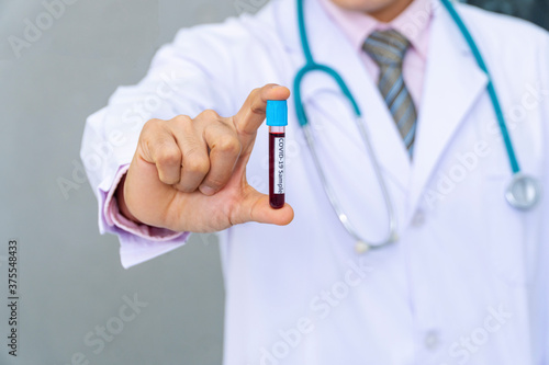 Hand of young man doctor wear uniform white clothes with stethoscope while holding test tube with covid19 blood sample on workplace. Select focus
