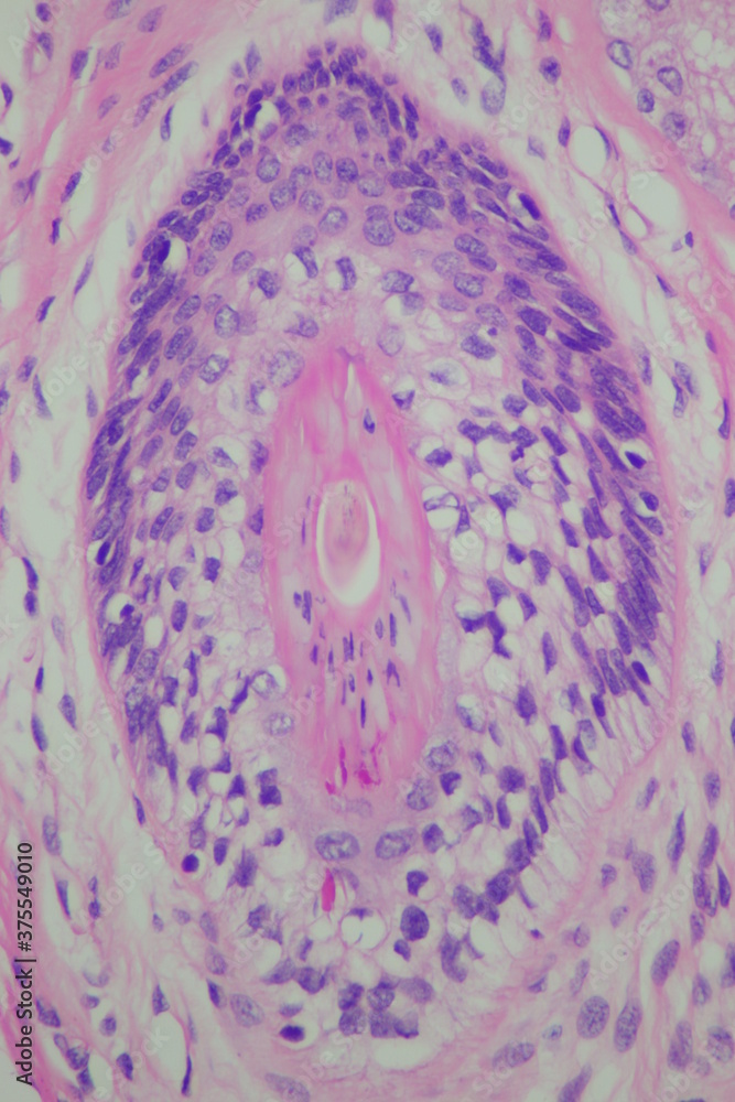 Normal hair follicle showing outer and inner root sheath, photo under microscope, magnification 400x Normal hair follicle showing outer and inner root sheath, photo under microscope, magnification 400x