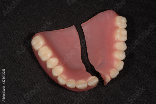 Close up of broken acrylic denture
