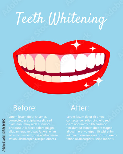 Teeth Whitening concept with laughed mouse and teeth before and after bleaching. With text places. Good for banners, posters. Vector isolated elemnts on blue background EPS10