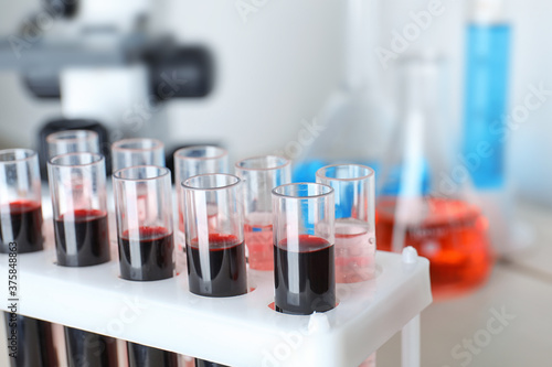 Test tubes with blood samples in rack on table, closeup. Laboratory analysis