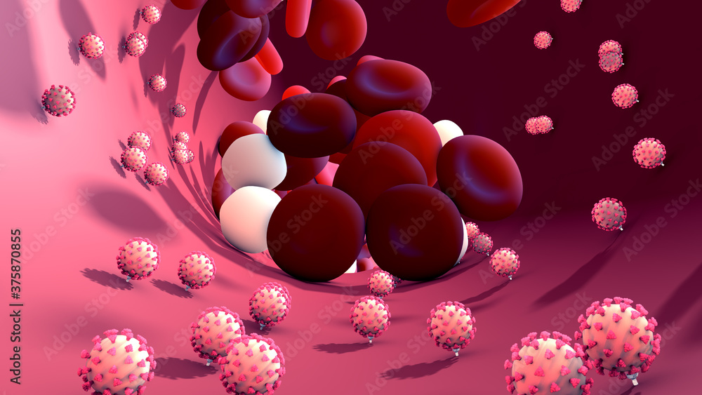 Coronavirus or virus causing blood clots to form in the blood system