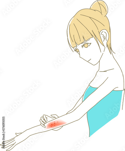 腕の湿疹を気にしている可愛い女性のイラスト