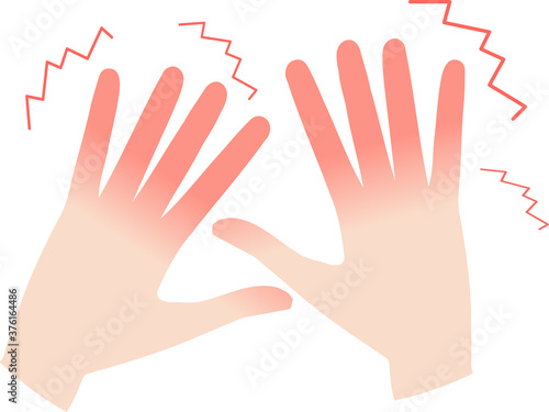 Wallpaper Mural 霜焼けで指先がヒリヒリしているイラスト Torontodigital.ca