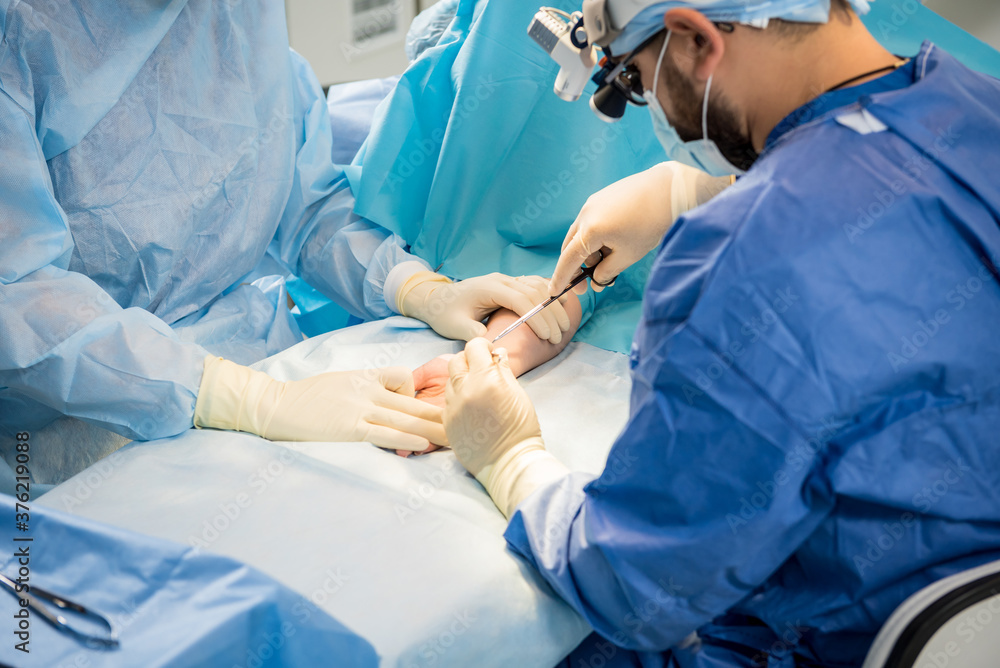 Surgeons in the operating room trying to save the patient's hand. Surgeons in the operating room trying to save the patient's hand.