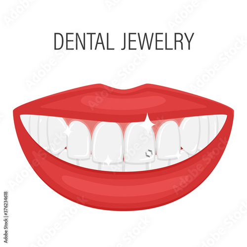 Smiling mouth. Rhinestone on the tooth. The decoration of the tooth. Dental jewelry. Beautiful female plump lips with even white teeth. Perfect smile. Isolated vector illustration in flat style