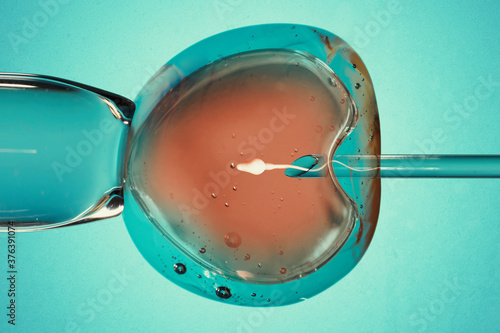 Ovum with needle and sperm for artificial insemination or in vitro fertilization. Concept of artificial insemination or fertility treatment. Image photo
